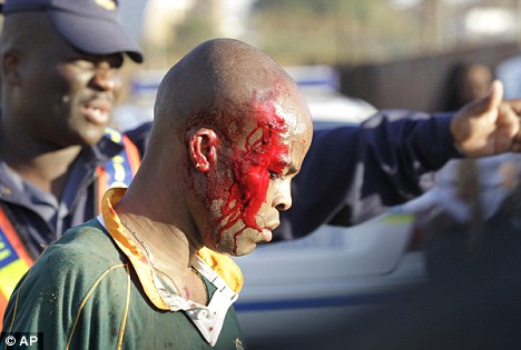 Một nạn nhân trong vụ giẫm đạp kinh hoàng